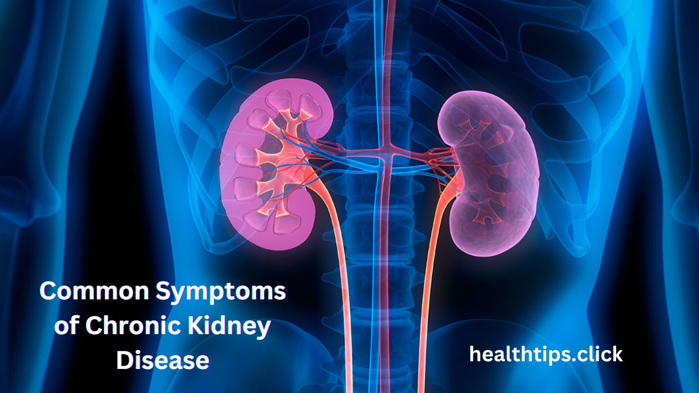 Common Symptoms of Kidney Disease