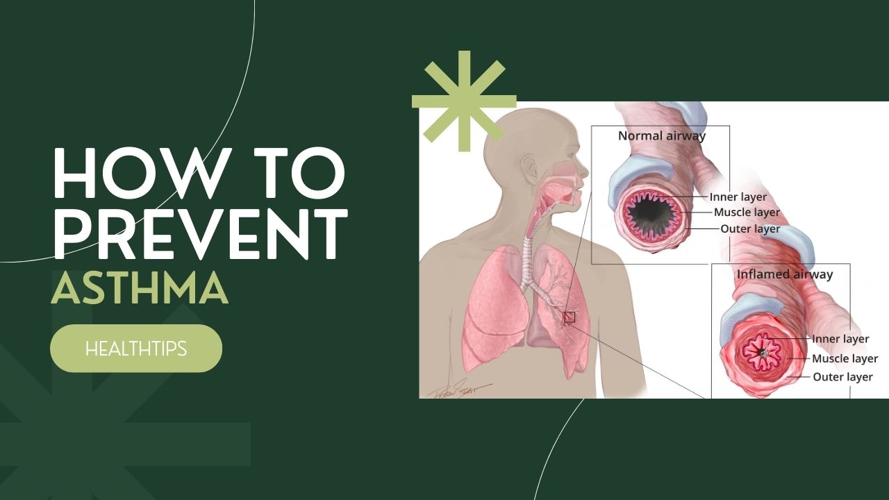 How to Prevent Asthma