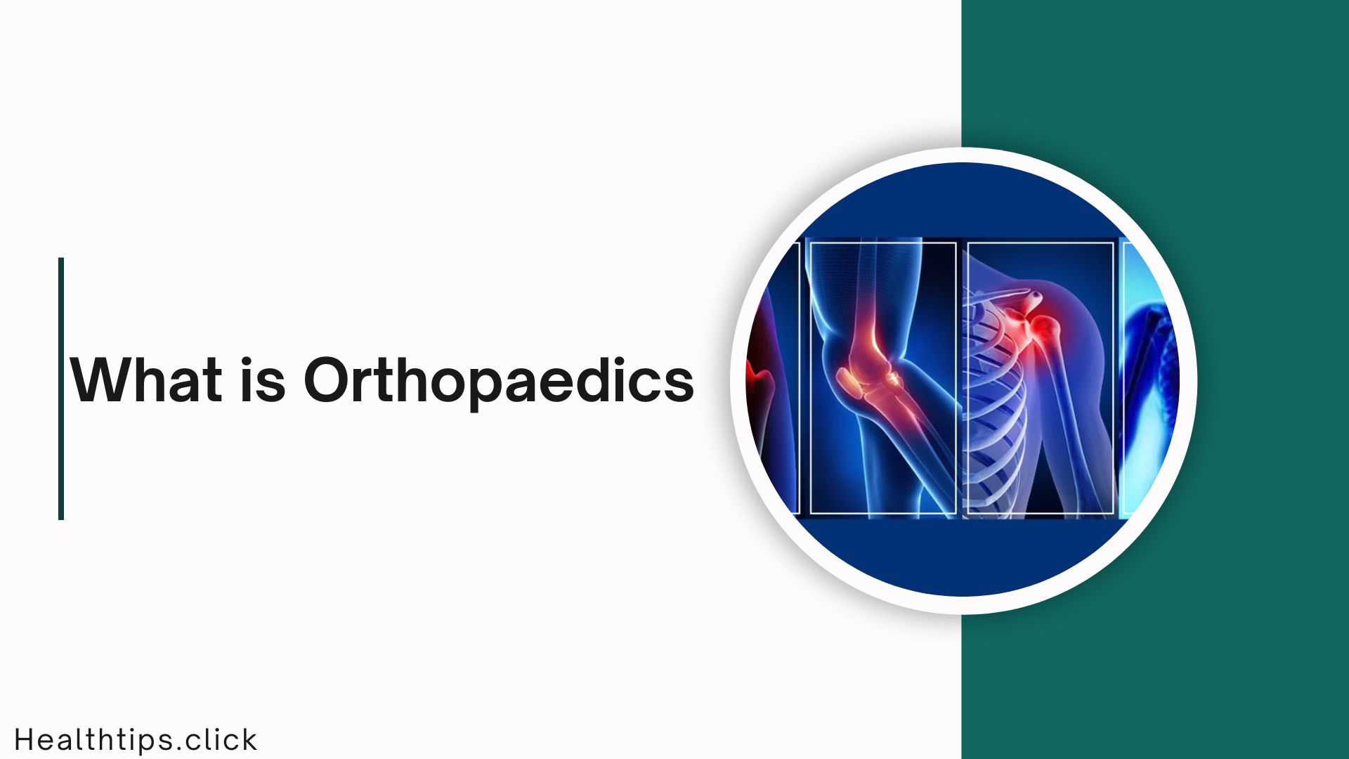 What is Orthopaedics