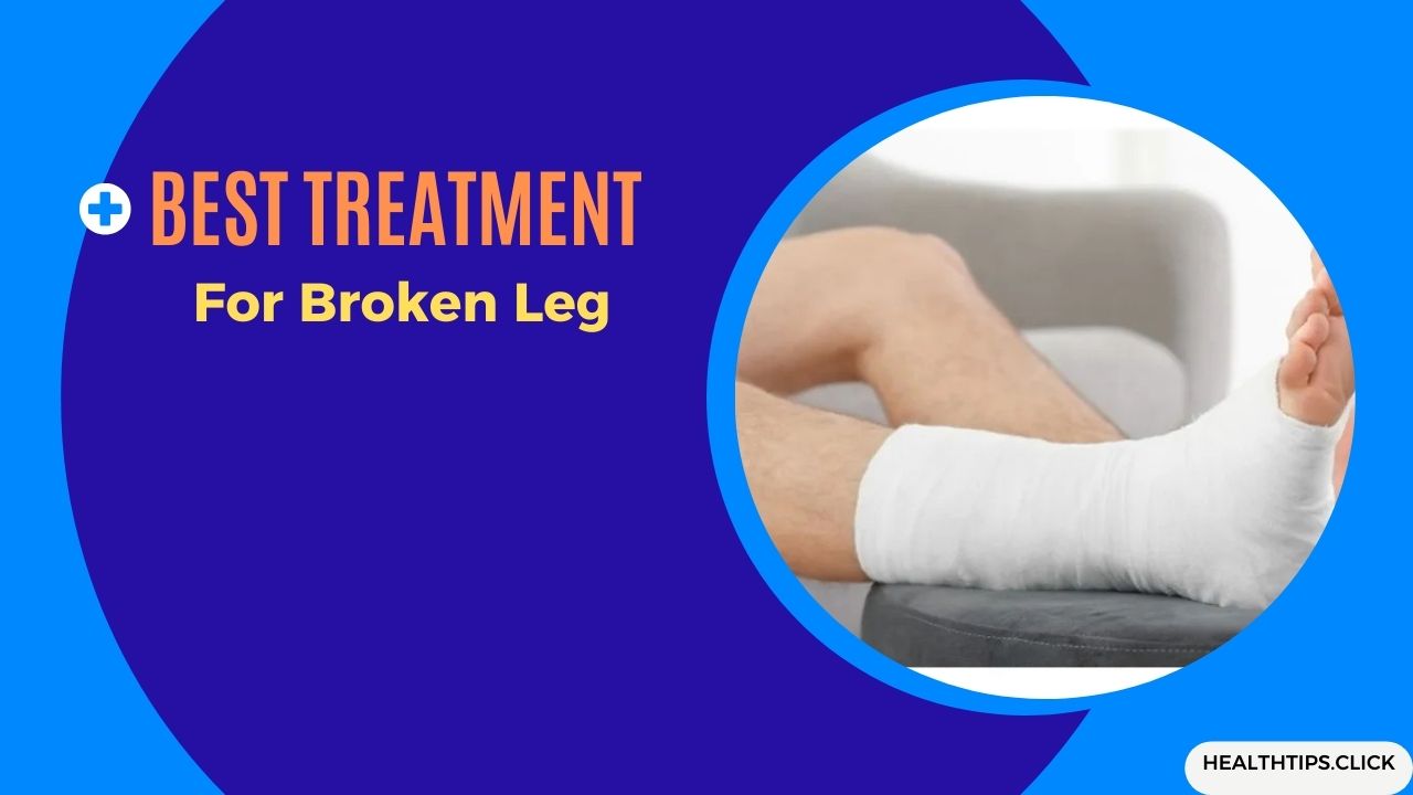 Best Treatment For Broken Leg