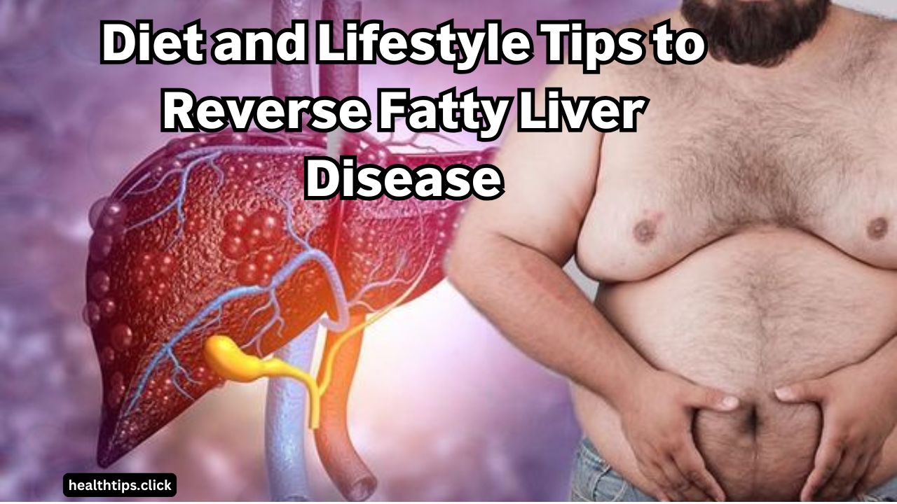 Tips to Reverse Fatty Liver Disease